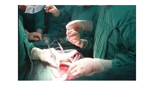 搭起心臟生命之橋——記濟(jì)寧人民醫(yī)院心外科主任張申教授團(tuán)隊(duì)